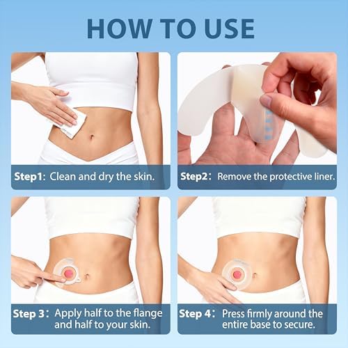 Brkiyom 50 Piezas de Tiras Elásticas para Barrera de Ostomía, Suministros Médicos Hidrocoloides para Bolsas de Colostomía, Sin Látex, Diseño Azul, - imagen 5