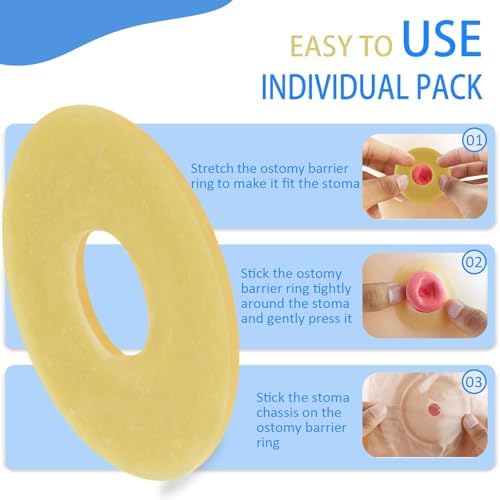 Anillo Barrera Ostomía TNTNDAY 40PCS, Anillos Adaptables de 2mm para Bolsa de Ostomía, Suministros para Colostomía, Ileostomía y Urostomía, Sellos - imagen 5