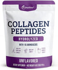 Colágeno Hidrolizado en Polvo Dr. Matthew - Suplemento Proteico Sin Sabor de Res Alimentada con Pasto para Piel, Cabello y Articulaciones - No GMO, - imagen 1