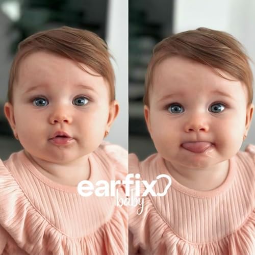 EarFix Corrector de Oídos para Bebés (Paquete de 8) – Parche Suave para Dar Forma a Oídos de Infantes de 3+ Meses – Cinta Hipoalergénica Impermeable - imagen 3