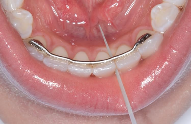Picks Dentales Opal Pix (Paquete de 10) 32 piezas por paquete. Palillos de plástico para cuidado bucal. No se rompen ni astillan. - imagen 7