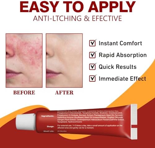 Crema de Hidrocortisona Seacall - Alivio Antipicazón para Eccema, Dermatitis e Irritaciones Cutáneas | Tratamiento Tópico de Máxima Fuerza - imagen 3
