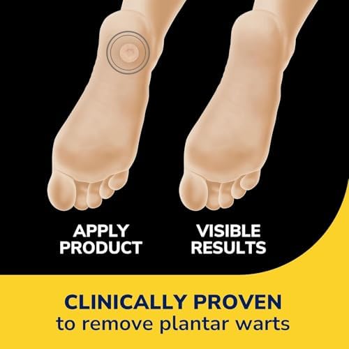 Dr. Scholl's Eliminador de Verrugas Clear Away Plantar 24 unidades (Paquete de 2) - imagen 5