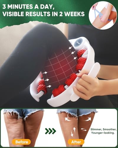 Removedor de Celulitis ONUEMP para Piernas, Rodillo Masajeador Muscular, Herramienta de Masaje para Muslos y Pantorrillas - Anticelulitis, Drenaje - imagen 3