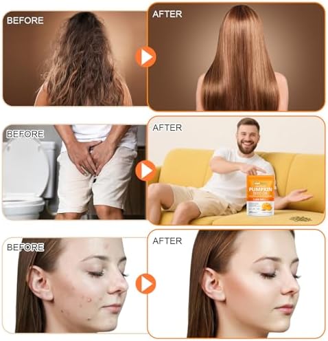 Cápsulas de Aceite de Semilla de Calabaza GTZSXNP, 2 en 1 con Saw Palmetto, Suplementos para el Crecimiento del Cabello y Salud de Vejiga y Próstata - imagen 4
