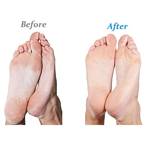 Rollos de Repuesto Extra Gruesos Emjoi Micro-Pedi con Tecnología SoftFLEX - Paquete de 4 - imagen 3