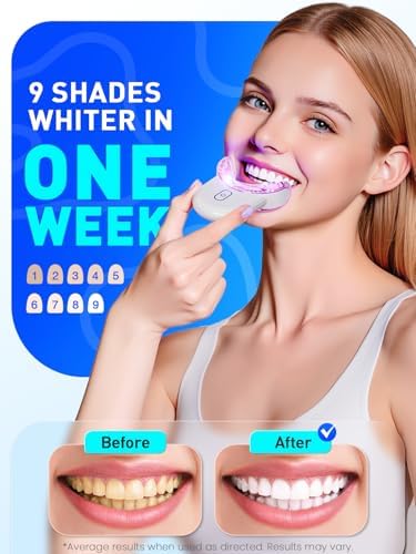 Kit de Blanqueamiento Dental con Luz LED: 3 Bolígrafos de Gel Blanqueador con 35% de Peróxido de Carbamida - Elimina Manchas de Café y Té - Luz LED - imagen 2