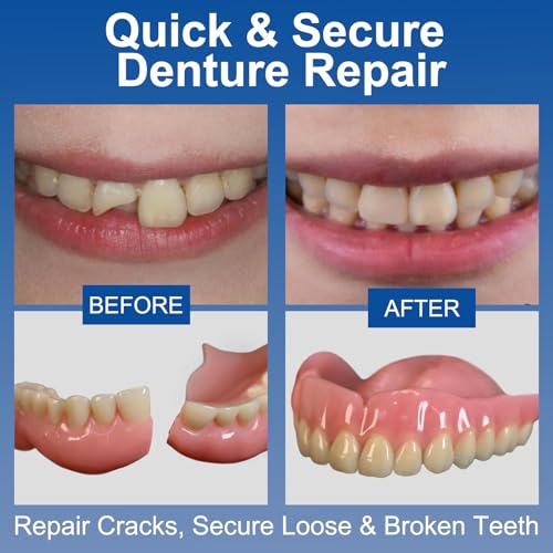 Pegamento Dental Instantáneo para Laboratorio (1oz), Repara Grietas y Asegura Dientes Flojos, Adhesivo Súper Fuerte—Dura Días a Semanas - imagen 5