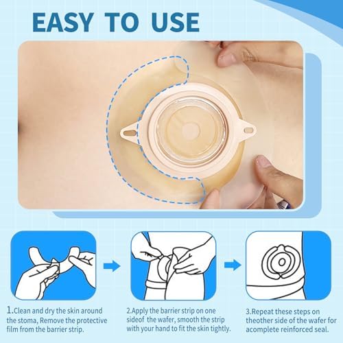 30 Piezas de Suministros para Ostomía, Tiras Adhesivas Elásticas para Barrera, Cinta para Bolsas de Colostomía y Ileostomía, Ideal para Estomas - imagen 5