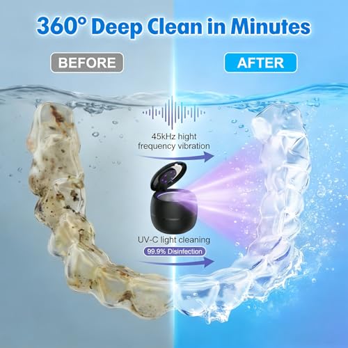 Limpiador Ultrasónico de Retenedores 2026 Mejorado, Baño Dental Inalámbrico 45kHz con Batería de 1800mAh, 4 Temporizadores y Tanque de Acero - imagen 2