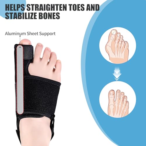 Férula para Hallux Valgus Recovist para Mujeres y Hombres | Corrector de Dedo Gordo, Alivio del Dolor y Alineación del Pie (1 Par) - imagen 2