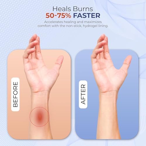 Kit de ros Auxilios BurnFIX® para Quemaduras, Recomendado por Médicos, 25 Piezas con Gel para Quemaduras, Vendaje, Guantes, Tijeras y Toallitas para - imagen 3