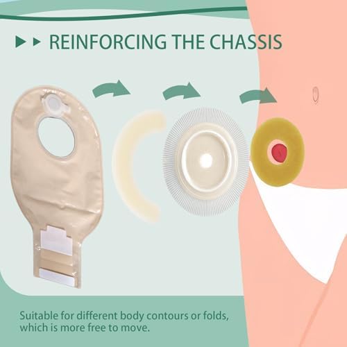 Anillos de Barrera Ostomía XIIFIIFII 30 Piezas, Cinta Hidrocoloide de 2mm, Sellos Cohesivos, Extensores de Piel Moldables para Bolsa de Colostomía, - imagen 4