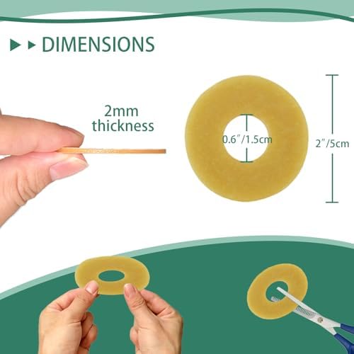 Anillos de Barrera Ostomía XIIFIIFII 30 Piezas, Cinta Hidrocoloide de 2mm, Sellos Cohesivos, Extensores de Piel Moldables para Bolsa de Colostomía, - imagen 5