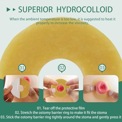 Anillos de Barrera Ostomía XIIFIIFII 30 Piezas, Cinta Hidrocoloide de 2mm, Sellos Cohesivos, Extensores de Piel Moldables para Bolsa de Colostomía, - imagen 6