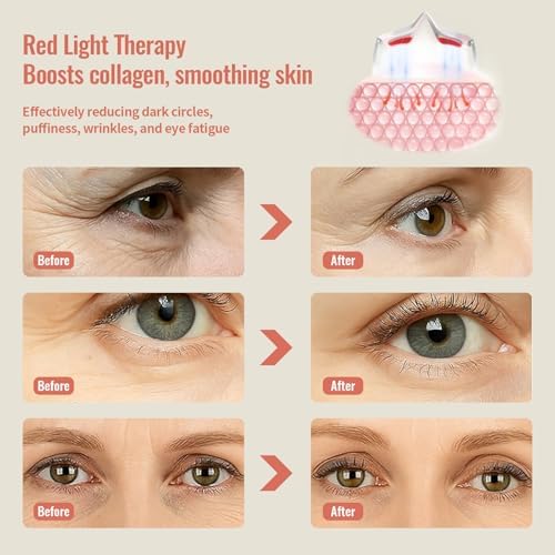 Gafas de Terapia de Luz Roja JCOTTON para Ojos, 4 Modos, Masajeador de Ojos Microcorriente, Reduce Bolsas, Ojeras, Hinchazón y Arrugas - imagen 2