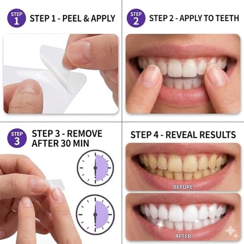 Tiras Blanqueadoras Dentley Moradas (42 Tiras) - Fórmula Segura para Esmalte, Ideal para Dientes Sensibles, Elimina Manchas Amarillas y Mal Aliento - imagen 4