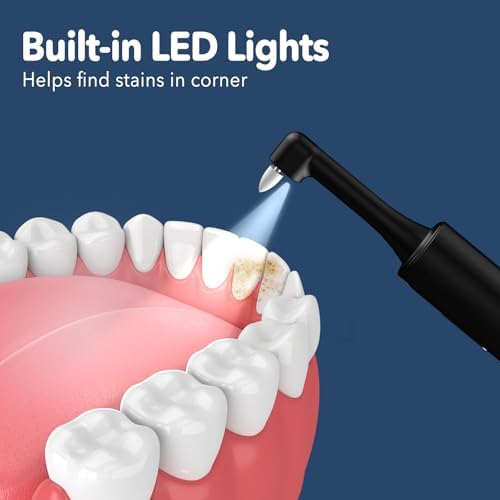 Pulidor Eléctrico de Dientes, Removedor de Placa para Blanqueamiento Dental, Kit de Pulido con 4 Modos de Velocidad, Recargable y a Prueba de Agua - imagen 4