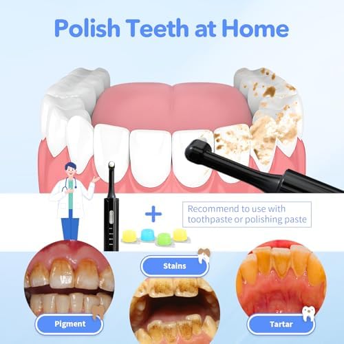 Pulidor Eléctrico de Dientes, Removedor de Placa para Blanqueamiento Dental, Kit de Pulido con 4 Modos de Velocidad, Recargable y a Prueba de Agua - imagen 6