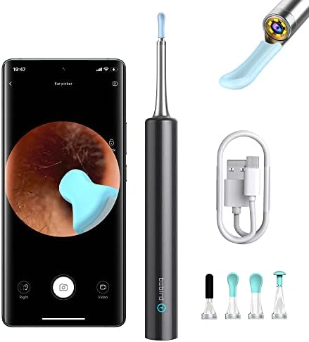 BEBIRD Limpiador de Oídos con Cámara, 5 Megapíxeles 1080P, 6 Luces LED, Set Completo de Herramientas para Remover Cerumen, 4 Cucharas, Negro - imagen 1