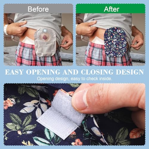 Cubiertas de Bolsa de Ostomía Seewey, 8 Piezas, Lavables, Ligeras y Protectores con Abertura Redonda, para Hombre y Mujer, Reducen Olores - imagen 5