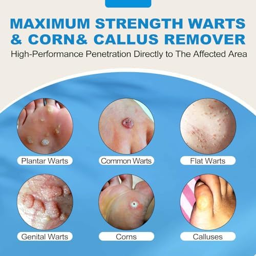 HIEKERS Eliminador de Verrugas Máxima Potencia - Líquido para Verrugas con Ácido Salicílico - Acción Rápida para Verrugas, Verrugas Plantares y - imagen 3