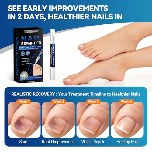 Lapicero para Tratamiento de Hongos en Uñas (5 Piezas) con 25% de Ácido Undecilénico, Máxima Potencia para Uñas Dañadas y Descoloridas - 5ml/0.18FLOZ - imagen 5
