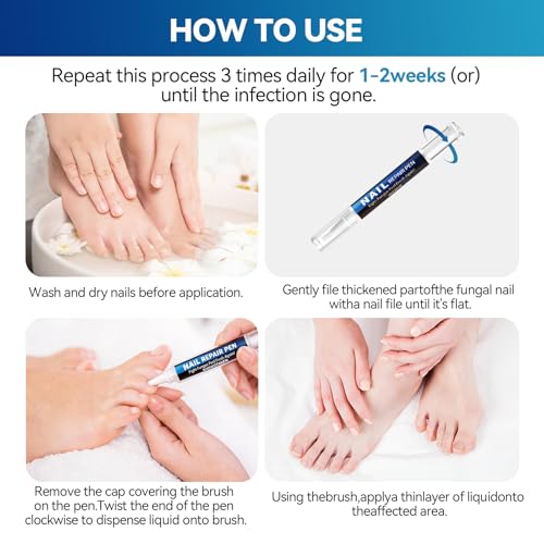 Lapicero para Tratamiento de Hongos en Uñas (5 Piezas) con 25% de Ácido Undecilénico, Máxima Potencia para Uñas Dañadas y Descoloridas - 5ml/0.18FLOZ - imagen 6