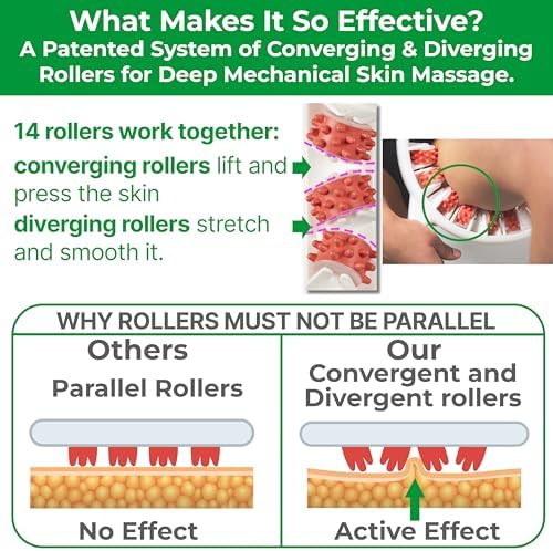 Masajeador Manual Anticelulitis TESMED: Hecho en Italia, Patente con Tecnología de Rodillos Convergentes y Divergentes para Muslos y Glúteos - imagen 5