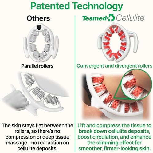 Masajeador Manual Anticelulitis TESMED: Hecho en Italia, Patente con Tecnología de Rodillos Convergentes y Divergentes para Muslos y Glúteos - imagen 6