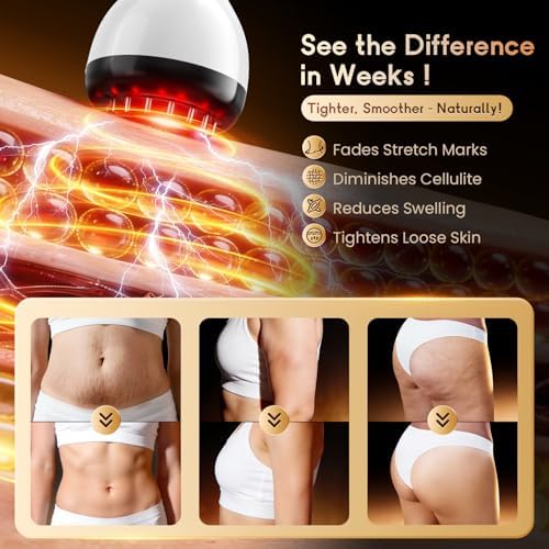 Masajeador de Drenaje Linfático y Anticelulitis, Reduce Estrías y Celulitis en Piernas, Brazos y Abdomen, Máquina de Esculpido Corporal con - imagen 6