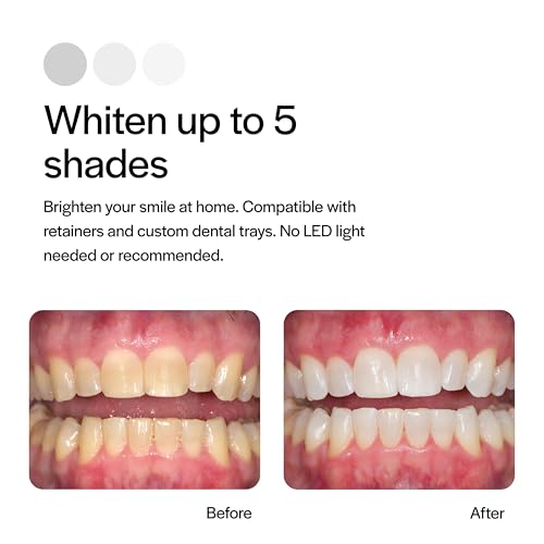 Kit de recarga Opalescence 20% para blanqueamiento dental (4 jeringas) con peróxido de carbamida. Sabor menta. Hecho por Ultradent. - imagen 4