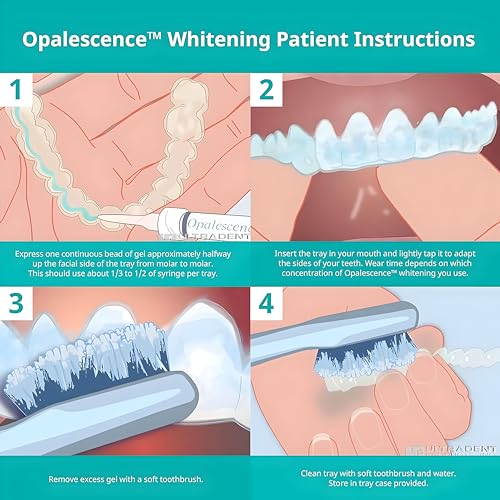 Kit de recarga Opalescence 20% para blanqueamiento dental (4 jeringas) con peróxido de carbamida. Sabor menta. Hecho por Ultradent. - imagen 5