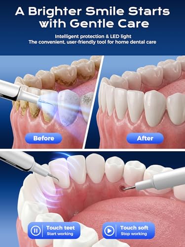 Removedor de Placa Dental Eléctrico, Limpiador de Sarro con 4 Modos y Luz LED, Kit Recargable de Herramientas Dentales con 3 Cabezas Reemplazables - imagen 2