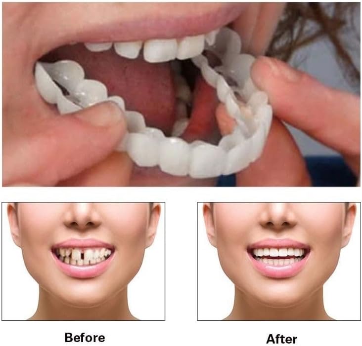 2 Paquetes de Kits de Blanqueamiento Dental para Mujeres y Hombres, Sonrisa Natural y Cómoda, Recupera tu Confianza - imagen 3