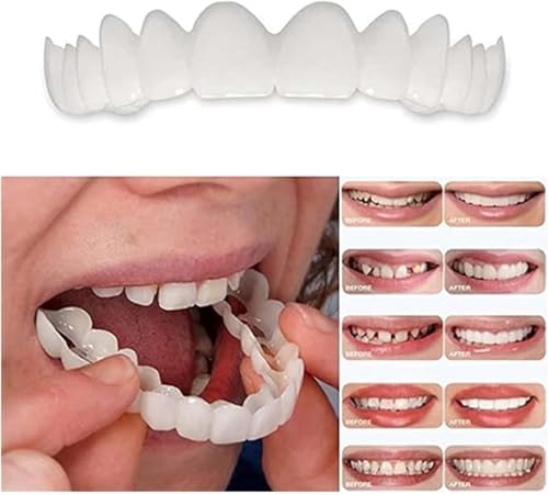 2 Paquetes de Kits de Blanqueamiento Dental para Mujeres y Hombres, Sonrisa Natural y Cómoda, Recupera tu Confianza - imagen 5