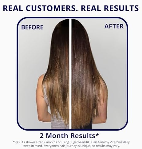 Gomitas Vitaminas para el Cabello SugarBearPro, 1 Mes, Biotina Extra Fuerte 6000mcg, Veganas, B12, MSM, Inositol, Omega 3, Saúco, Kosher, Halal, Sin - imagen 8