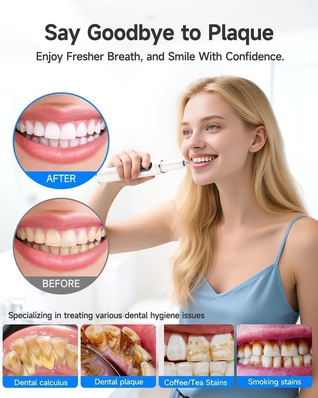 Limpiador de Placa RELACS 7000 para Dientes, Removedor de Sarro, Kit de Limpieza Dental con 5 Modos de Velocidad y 3 Cabezas Intercambiables, con Luz - imagen 2