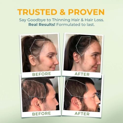VITAL NUTRITIVE Complejo Vital para el Cabello - Vitaminas para el Crecimiento del Cabello para Mujeres y Hombres - Biotina y Vitamina B - Suplemento - imagen 7