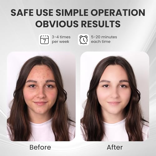 Máscara Facial LED Gelpal 7 en 1 Terapia de Luz Roja para el Rostro, Cuidado de la Piel, Uso en Casa o Salón, Color Blanco. - imagen 4