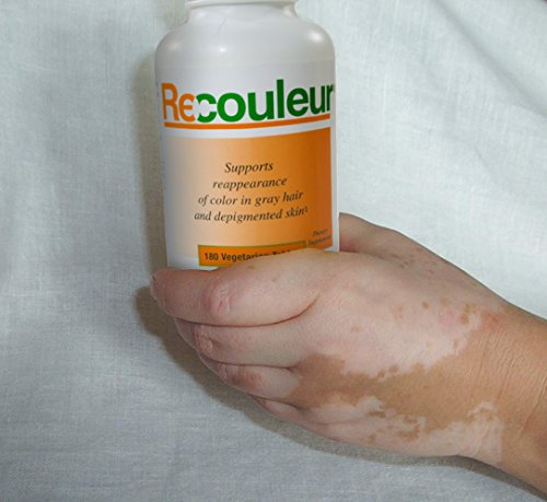 recouleur vitaminas para vitiligo