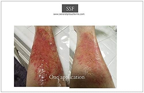 recuperación avanzada con ingredientes naturales