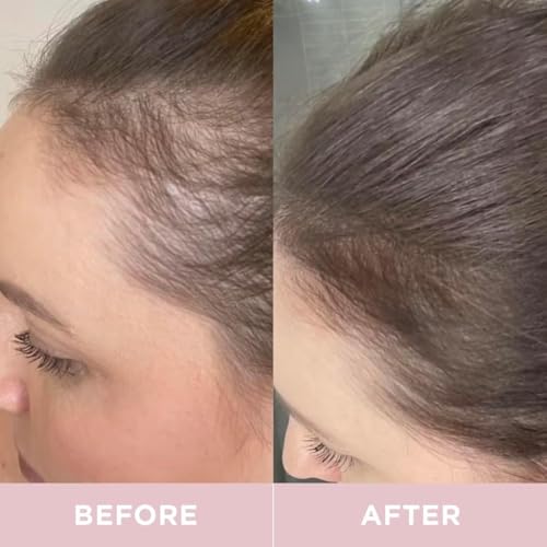 revitaliza tu piel con colágeno