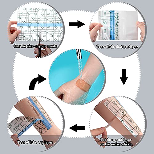Rollos de venda para protección de heridas
