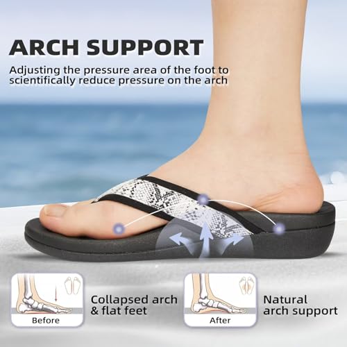sandalias que alivian el dolor