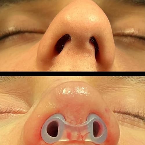 splint nasal de silicona 100% alta calidad