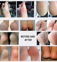 spray exfoliante para pies Wonder Pedi