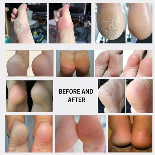 spray exfoliante para pies Wonder Pedi