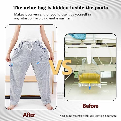 suministros para ostomía de alta calidad