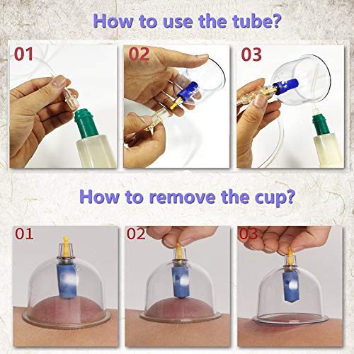 terapia alternativa con copas biomagnéticas